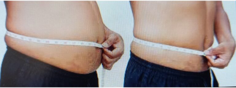 RUCH CZY DIETA – ODWIECZNY DYLEMAT